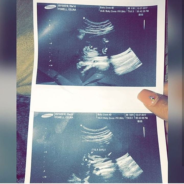 Grouie Ultrasound Photos Claiming Rapper Offset As Father