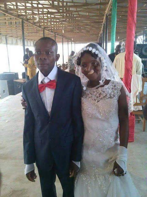 Woman Born With Facial Deformity Got Married In Anambra (2)