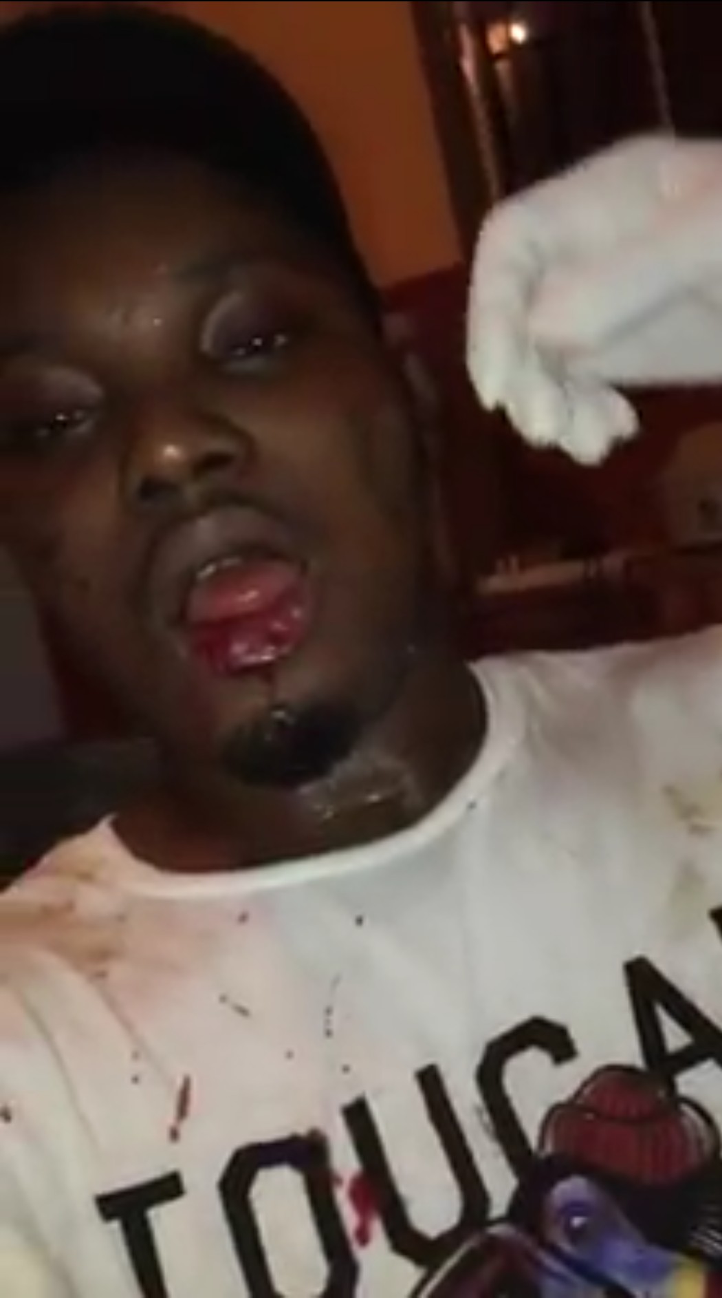 Nigerian Man Who Was Defending His Girlfriend From An Abuser Got His Lips Bitten (5)