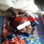 2-Year-Old Boy Whose Eyes Were Plucked Out By Ritualists In Jalingo