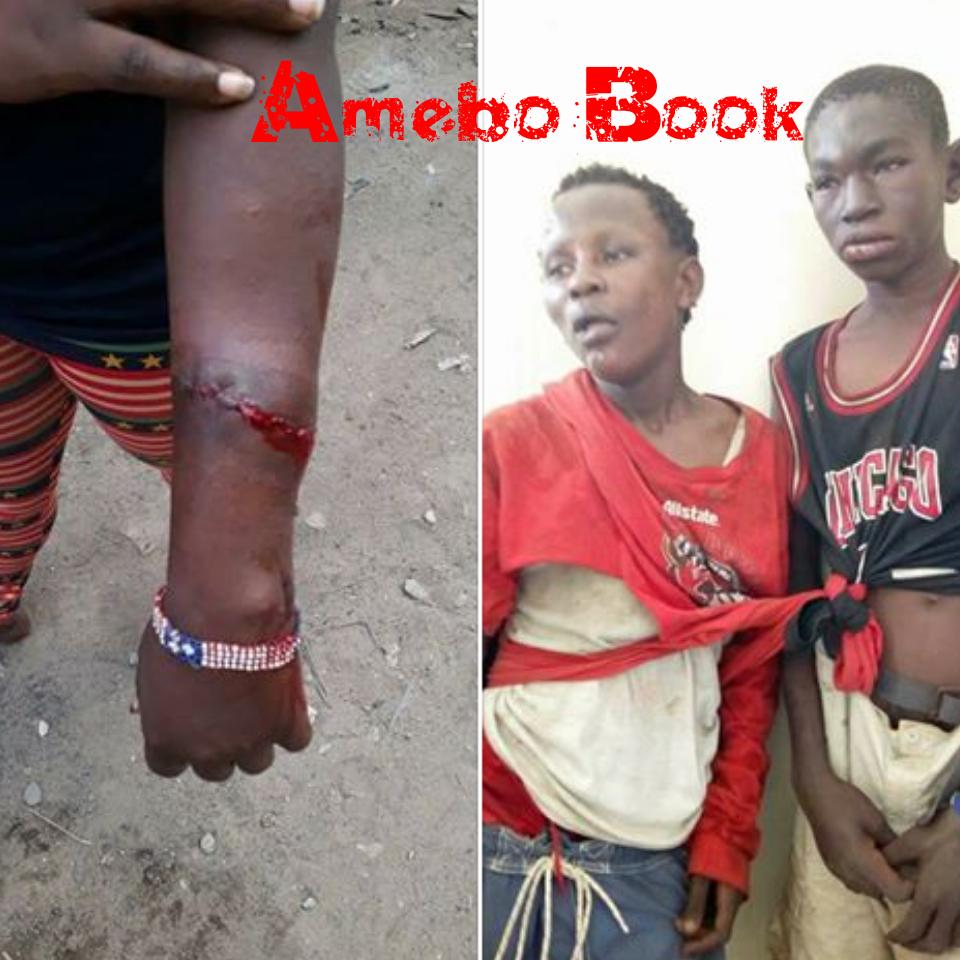 13-Year-Old Robbers Mercilessly Beaten After Inflicting Knife Wounds On Female