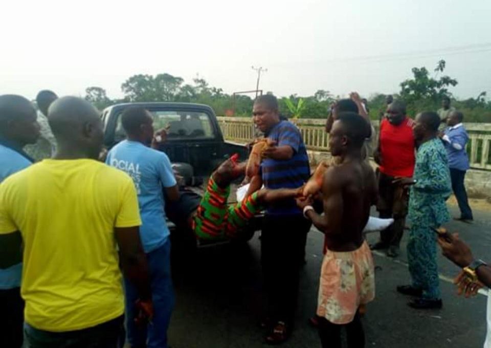 Collision Of Two Cars Destroyed A Man's Leg In Bayelsa State
