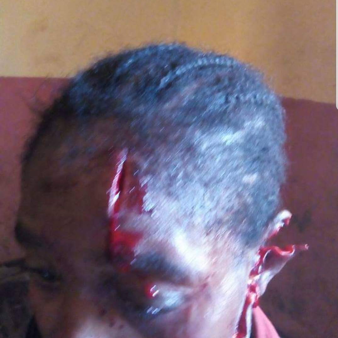 Woman Fights Off Fulani Herdsmen Who Tried To Rape Her At Gunpoint In Her Farm (3)