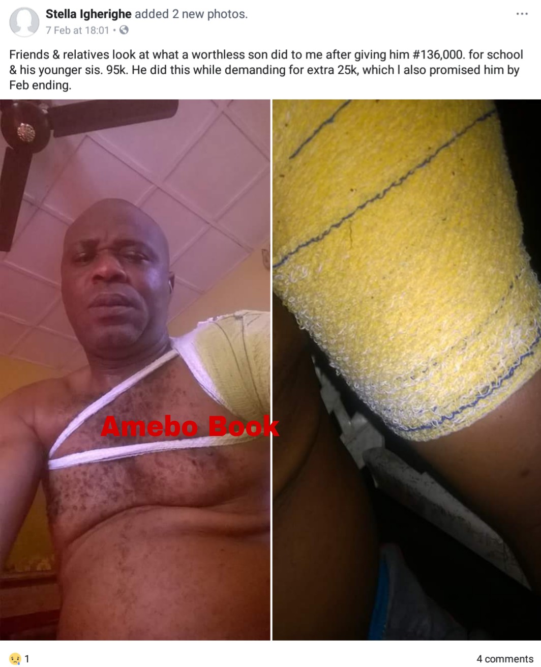 Nigerian Father Cries Out After Being Mercilessly Beaten Up By Son Over More Money (2)