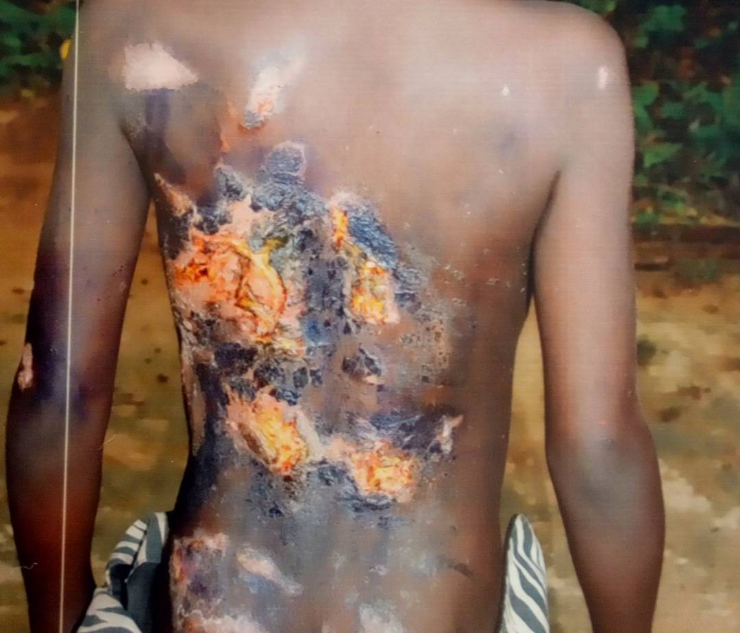 Woman Physically Abused Her 3 Grandchildren Over Witchcraft (4)