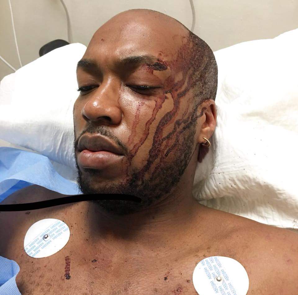 Nigerian Man On Holiday With Family Recounts Vicious Attack In Mexico (3)