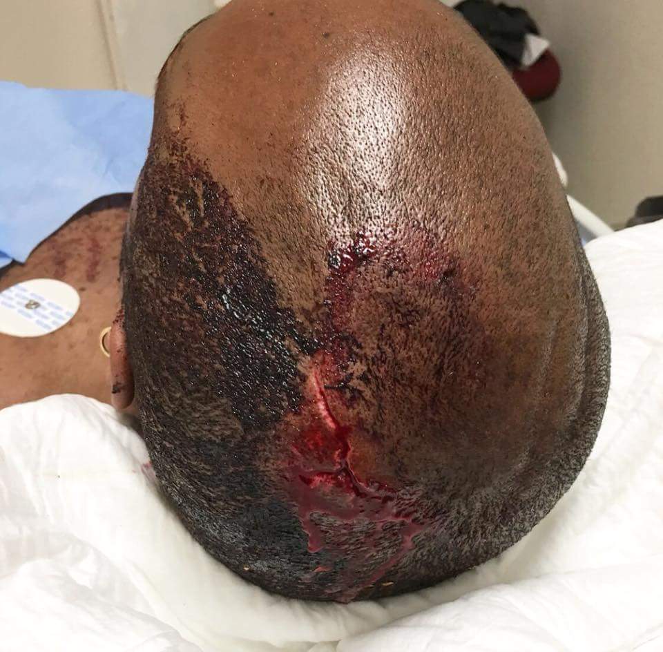 Nigerian Man On Holiday With Family Recounts Vicious Attack In Mexico (4)