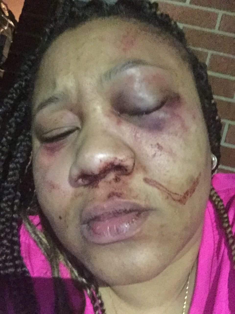 Pennsylvania Woman Janea Alston-Goggins Almost Beaten To Death By Her Fiance (3)