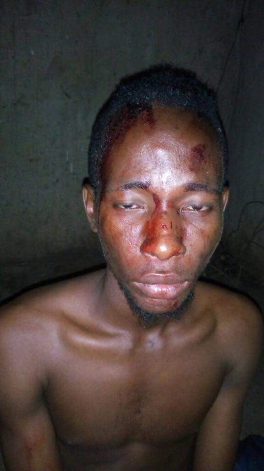 Man Celebrates After He Was Nearly Killed By A Drunk Policeman (2)