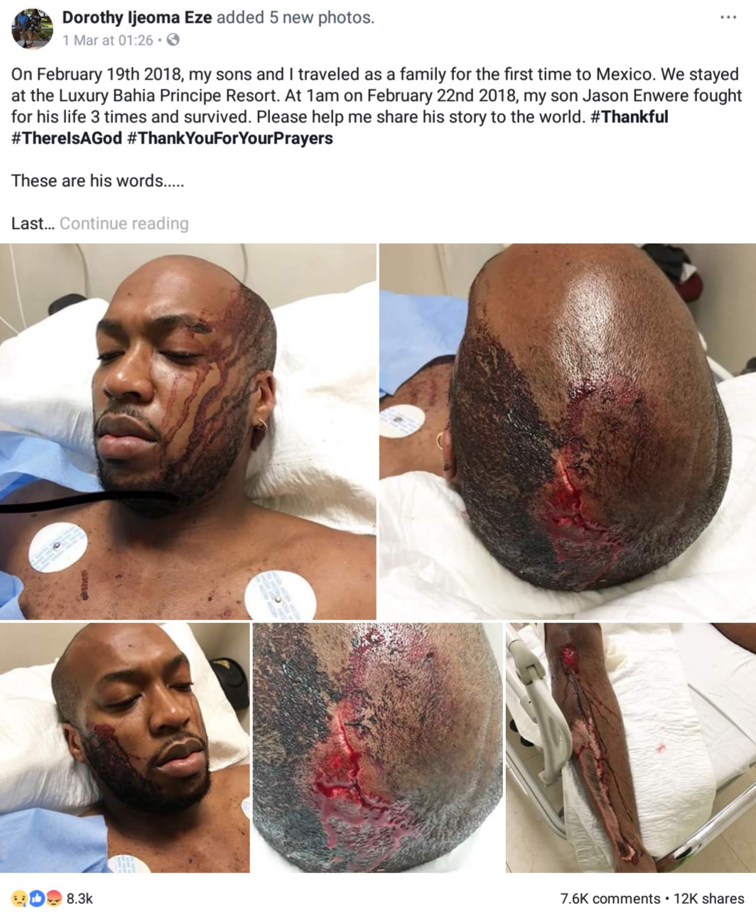 Nigerian Man On Holiday With Family Recounts Vicious Attack In Mexico (2)