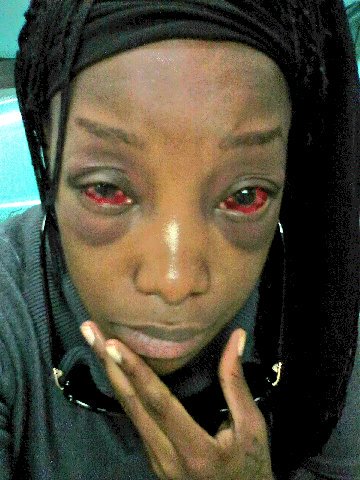 Lady Almost Beaten To Death By Taxify Driver In South Africa (5)