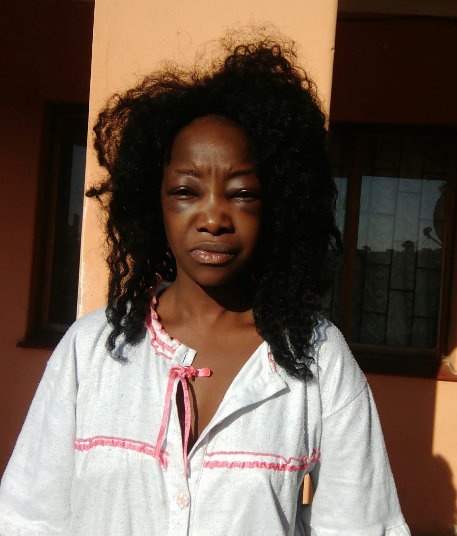 Lady Almost Beaten To Death By Taxify Driver In South Africa (6)