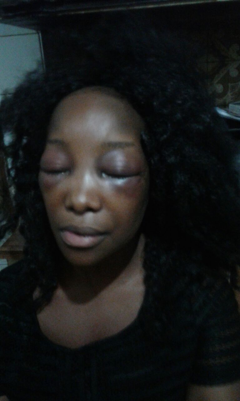 Lady Almost Beaten To Death By Taxify Driver In South Africa (7)