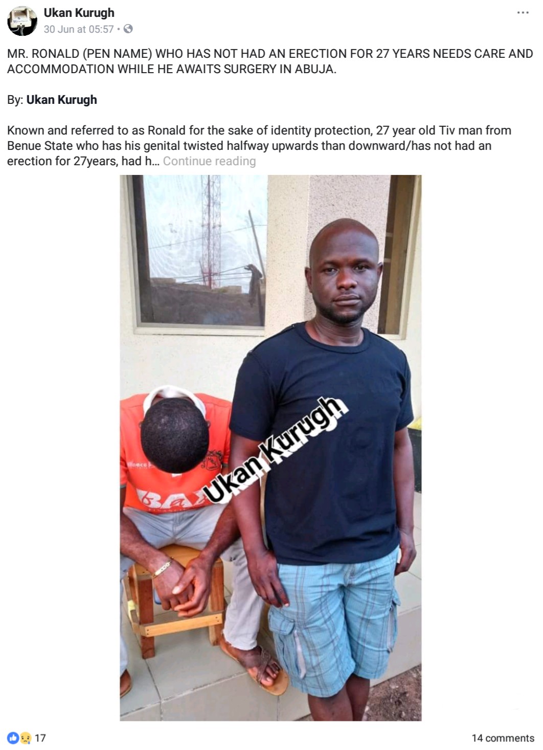 27-Year-Old Nigerian Man Who Has Never Had An Erection