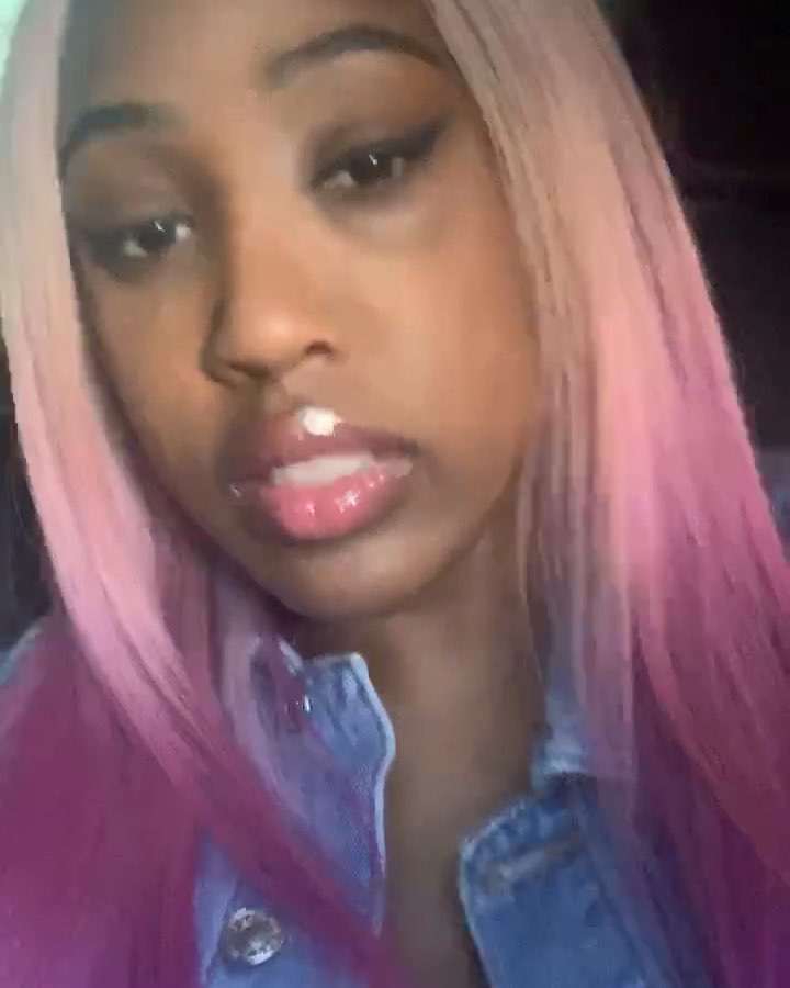 Brittney Taylor Blames Remy Ma For Black Eye (2)