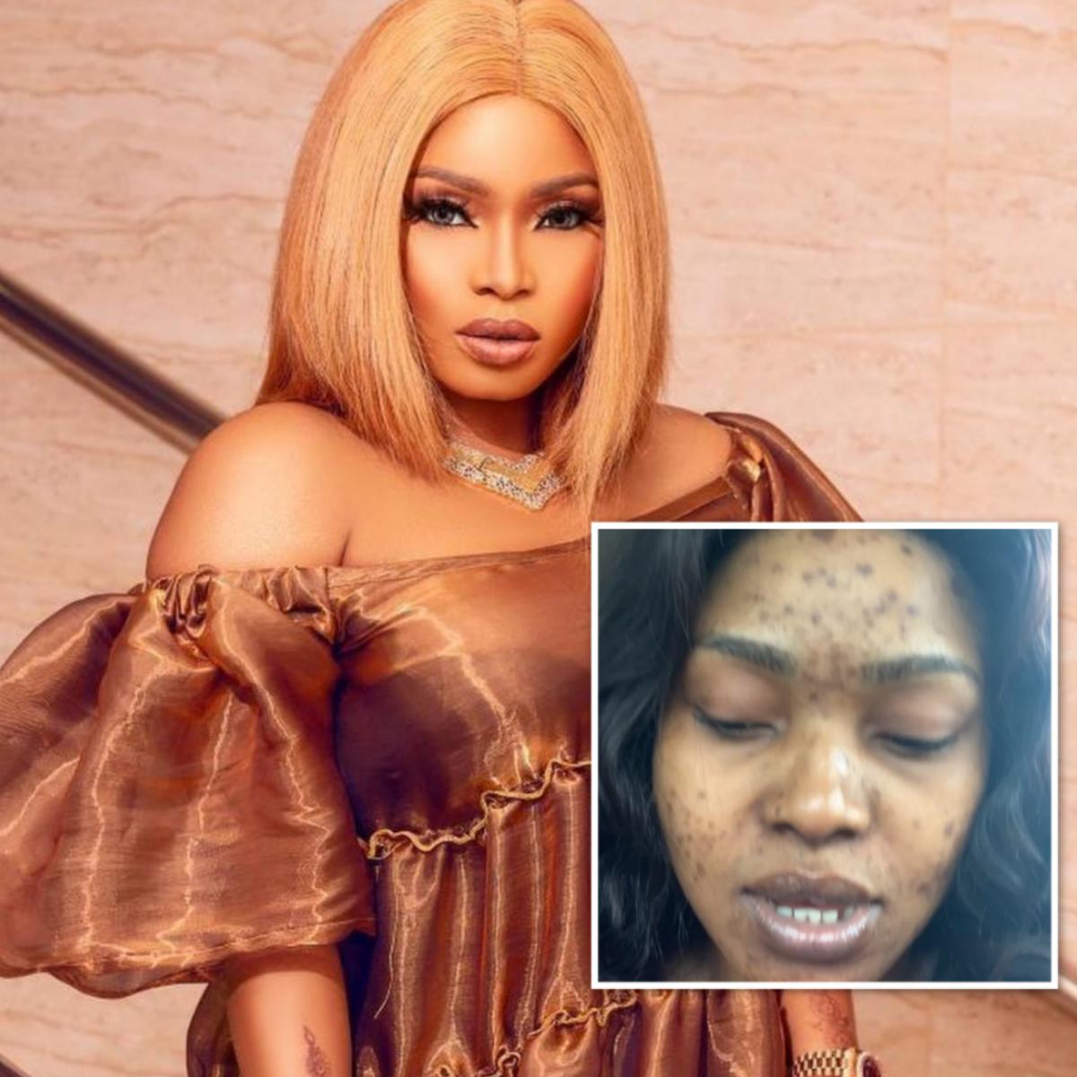 Halima Abubakar Face Completely Covered With Black Spots